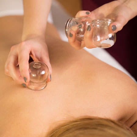 Cupping Therapy